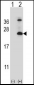 TSPAN6 Antibody (C-term)